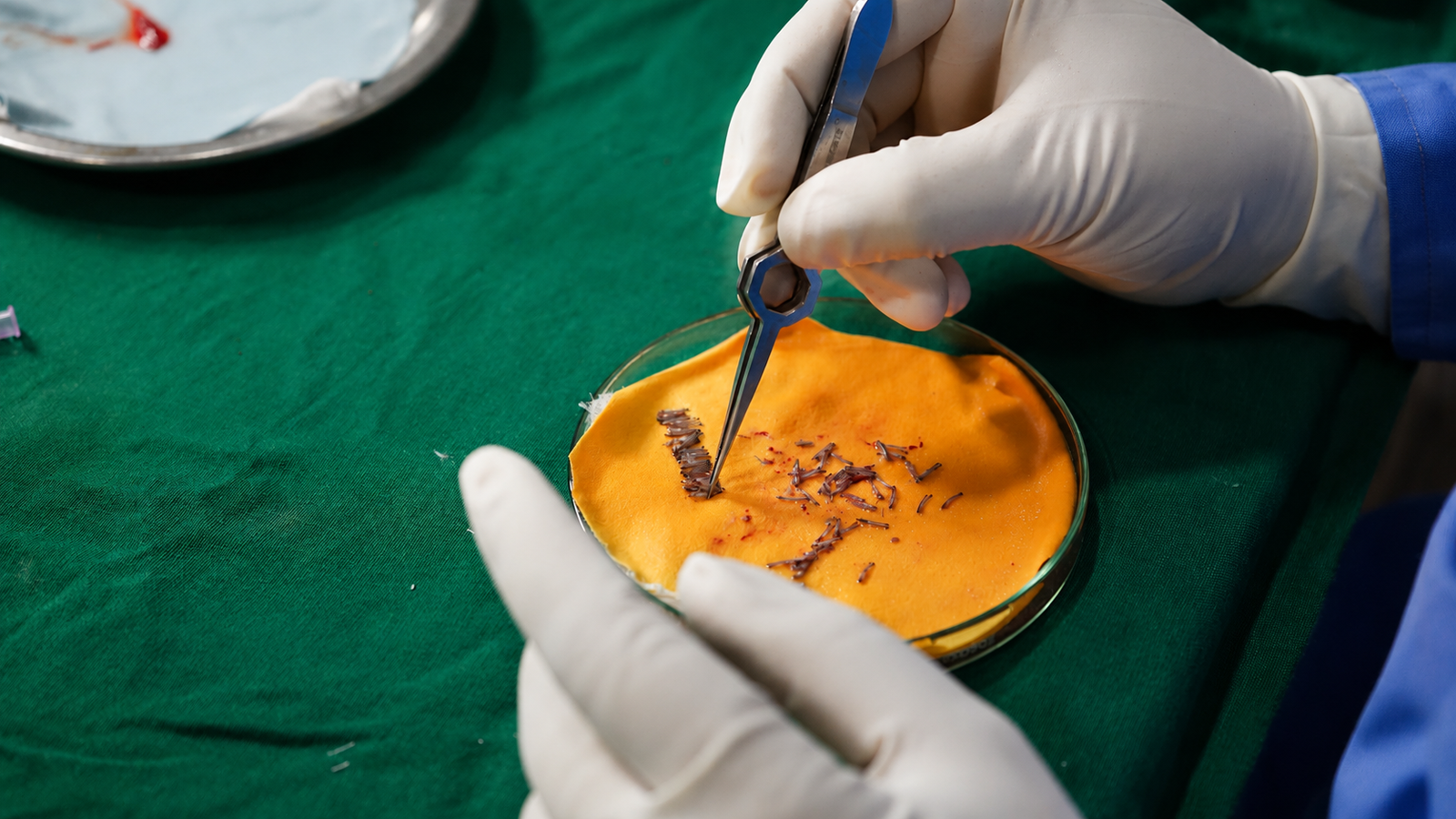 Stem Cell Therapy
